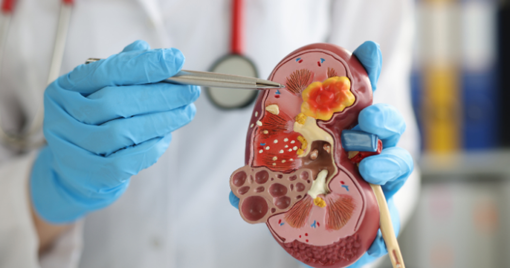 suy than man nguy hiem the nao 1774408686779707187332 0 64 450 784 crop 17744165857441354597981