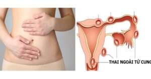 thumb thai ngoai tu cung 1774600899935384034705 1774600921051581963129