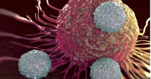 ung thu phoi hiem gap 5 17742535197141220269159 0 0 414 663 crop 17742535406281305689448