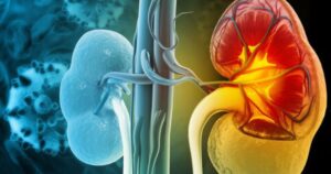 benh suy than an duoc khoai tay khong 17769318763481641807325 0 128 720 1280 crop 17769319246941759810483