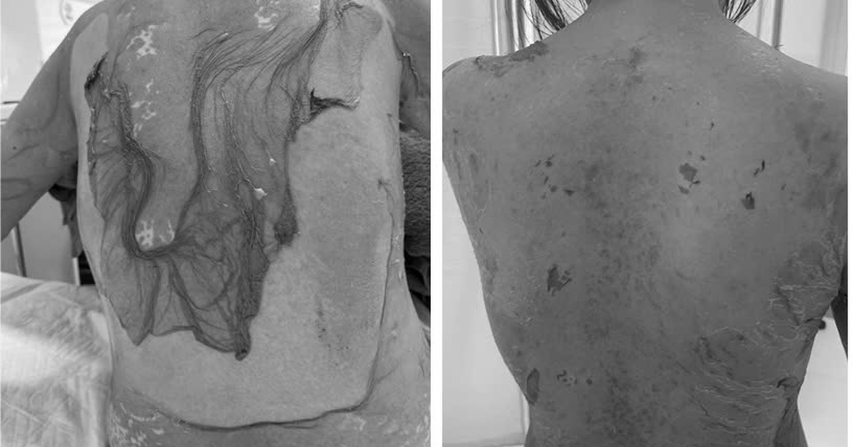 da bong troc toan than 17770474751301505705731 0 0 509 815 crop 17770474939221052298047