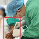 ton thuong mu ban tay 1775142354704707111515 198 0 1478 2048 crop 17751424295311132189508