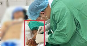 ton thuong mu ban tay 1775142354704707111515 198 0 1478 2048 crop 17751424295311132189508