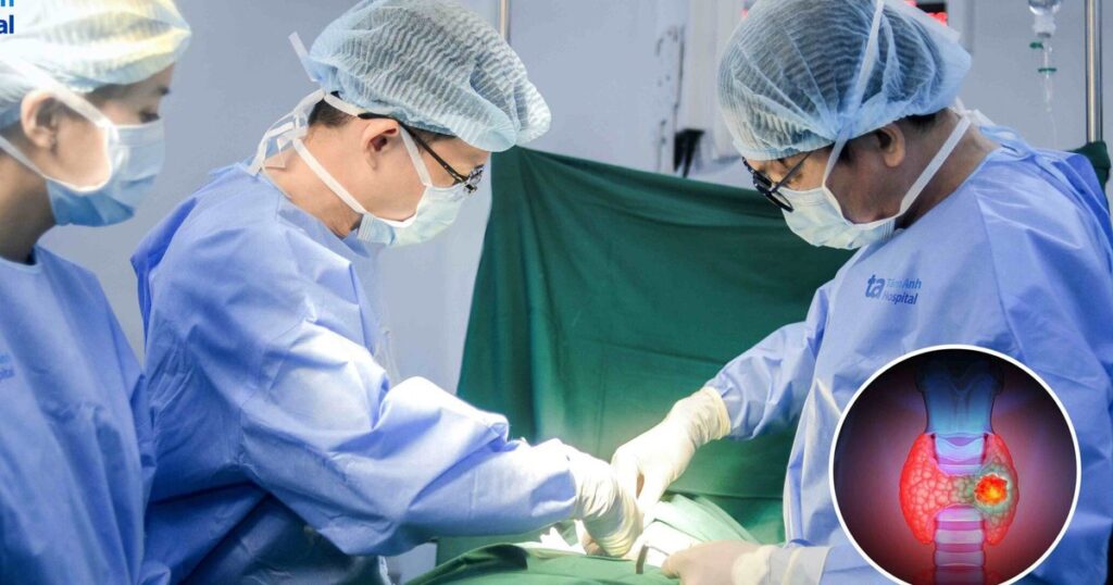 ung thu tuyen giap di can 17770464914472107457238 33 323 1046 1943 crop 1777046510836740343755