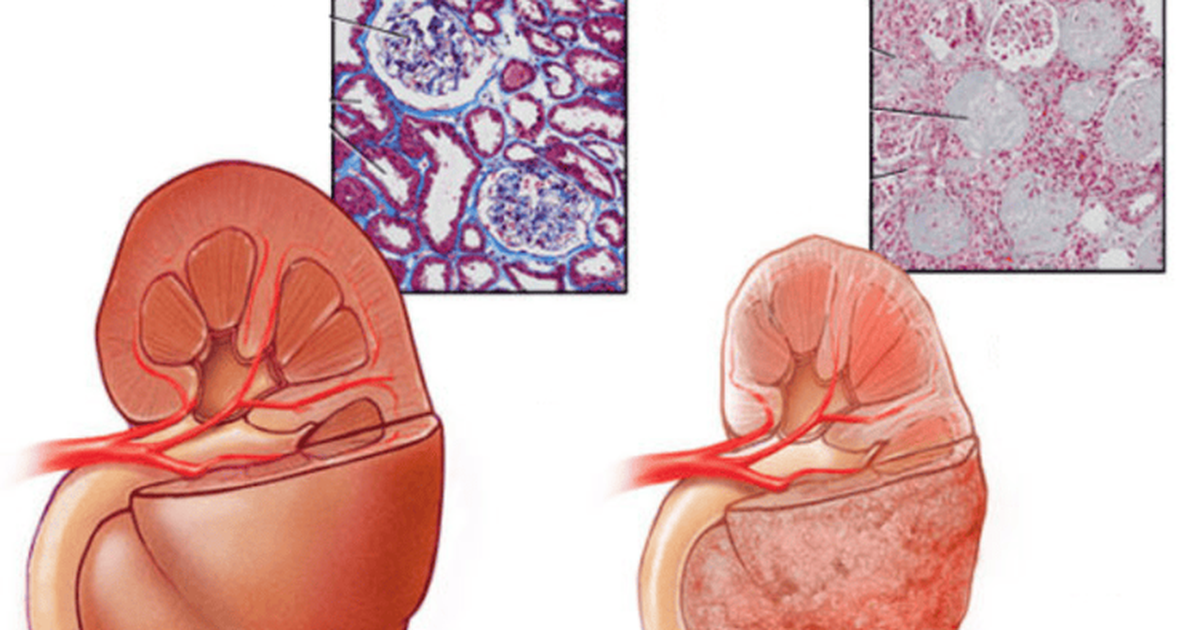 suy than 5 1781771855431676456740 0 0 469 750 crop 1781771914110878642296