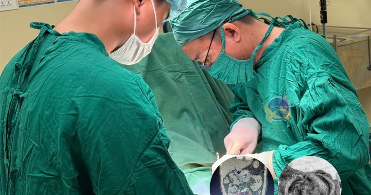ung thu bang quang 17871951883531983492697 101 0 581 768 crop 1787195226416192996163