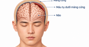 dau dau 17905681351661788251226 0 0 500 800 crop 1790568151215761578107