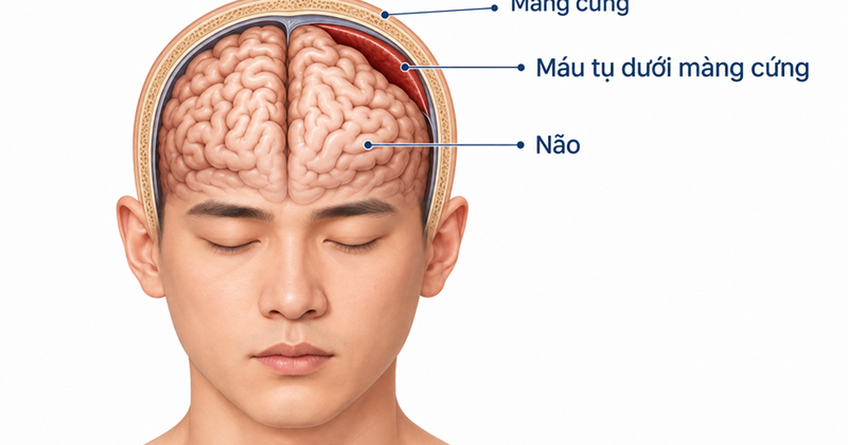 dau dau 17905681351661788251226 0 0 500 800 crop 1790568151215761578107
